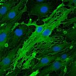 Endomucin Antibody in Immunocytochemistry (ICC/IF)