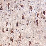 AgRP Antibody in Immunohistochemistry (Paraffin) (IHC (P))