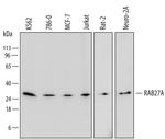 RAB27A Antibody in Western Blot (WB)