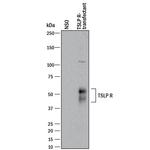 TSLP Receptor Antibody in Western Blot (WB)