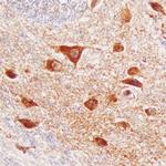 VWC2 Antibody in Immunohistochemistry (Paraffin) (IHC (P))