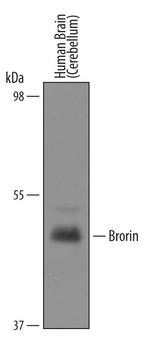 VWC2 Antibody in Western Blot (WB)