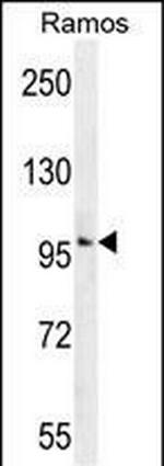 PGCD Antibody in Western Blot (WB)