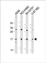 TMEM100 Antibody in Western Blot (WB)