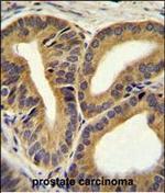 TRIM65 Antibody in Immunohistochemistry (Paraffin) (IHC (P))