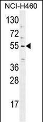 TRIM65 Antibody in Western Blot (WB)