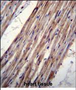 Kir6.1 (KCNJ8) Antibody in Immunohistochemistry (Paraffin) (IHC (P))