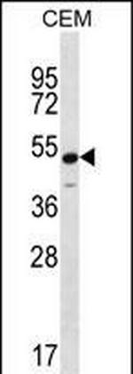 Kir6.1 (KCNJ8) Antibody in Western Blot (WB)