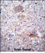 PCDHA7 Antibody in Immunohistochemistry (Paraffin) (IHC (P))