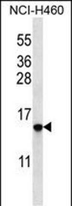 Histone H2B.2 Antibody in Western Blot (WB)