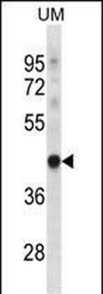 TRUB1 Antibody in Western Blot (WB)