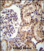 RNF43 Antibody in Immunohistochemistry (Paraffin) (IHC (P))