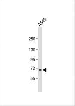 RNF43 Antibody in Western Blot (WB)