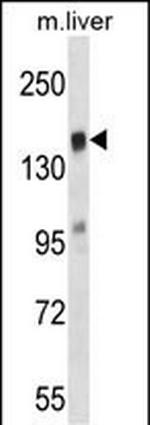 TIAM2 Antibody in Western Blot (WB)