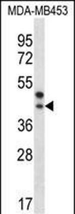 PPT2 Antibody in Western Blot (WB)