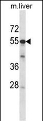 ADCK2 Antibody in Western Blot (WB)