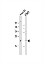 HSPB9 Antibody in Western Blot (WB)