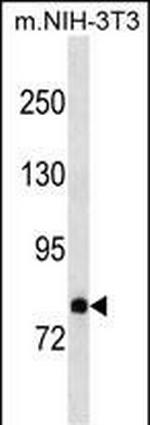 DAB2 Antibody in Western Blot (WB)