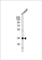 Nkx2.5 Antibody in Western Blot (WB)