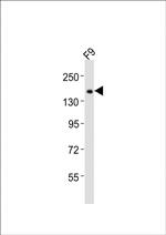 TET1 Antibody in Western Blot (WB)