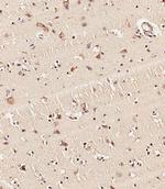 KMT2D Antibody in Immunohistochemistry (Paraffin) (IHC (P))