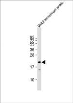 KMT2D Antibody in Western Blot (WB)