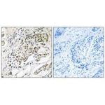 CDYL2 Antibody in Immunohistochemistry (Paraffin) (IHC (P))