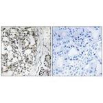 PEX14 Antibody in Immunohistochemistry (Paraffin) (IHC (P))