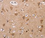 ALG9 Antibody in Immunohistochemistry (Paraffin) (IHC (P))