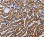 ALG9 Antibody in Immunohistochemistry (Paraffin) (IHC (P))