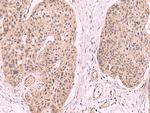 KLRB1 Antibody in Immunohistochemistry (Paraffin) (IHC (P))