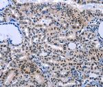 COX18 Antibody in Immunohistochemistry (Paraffin) (IHC (P))