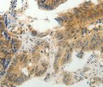 CMTM7 Antibody in Immunohistochemistry (Paraffin) (IHC (P))