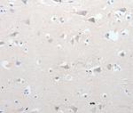 GCH1 Antibody in Immunohistochemistry (Paraffin) (IHC (P))