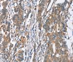 SLC4A1 Antibody in Immunohistochemistry (Paraffin) (IHC (P))