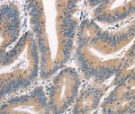 CRIM1 Antibody in Immunohistochemistry (Paraffin) (IHC (P))