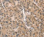 CRIM1 Antibody in Immunohistochemistry (Paraffin) (IHC (P))