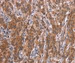 FDCSP Antibody in Immunohistochemistry (Paraffin) (IHC (P))