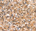 SLC34A3 Antibody in Immunohistochemistry (Paraffin) (IHC (P))