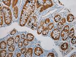 SULT1B1 Antibody in Immunohistochemistry (Paraffin) (IHC (P))