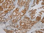 SULT1B1 Antibody in Immunohistochemistry (Paraffin) (IHC (P))