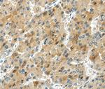 TRIB1 Antibody in Immunohistochemistry (Paraffin) (IHC (P))