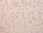 ZCCHC9 Antibody in Immunohistochemistry (Paraffin) (IHC (P))