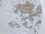 GSTM4 Antibody in Immunohistochemistry (Paraffin) (IHC (P))