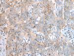 SDCCAG8 Antibody in Immunohistochemistry (Paraffin) (IHC (P))