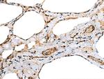 Cardiac Troponin C Antibody in Immunohistochemistry (Paraffin) (IHC (P))