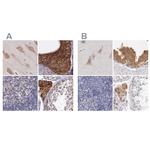 NSDHL Antibody in Immunohistochemistry (IHC)