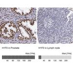 Histone 1F0 Antibody in Immunohistochemistry (IHC)