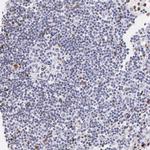 Histone 1F0 Antibody in Immunohistochemistry (IHC)