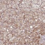 CXorf57 Antibody in Immunohistochemistry (Paraffin) (IHC (P))